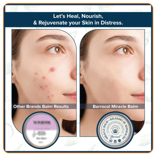 Heal, Nourish skin